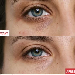 Skin Therapy Eye
